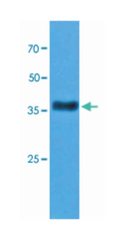 KRT23, Mouse, Clone: AT2F6, Abnova 100&mu;L; Unlabeled:Antibodies, Monoclonal