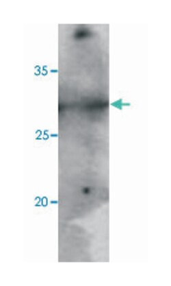PNMT, Mouse, Clone: AT1C11, Abnova 100&mu;L; Unlabeled:Antibodies, Monoclonal