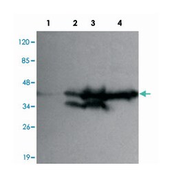 EPCAM, Mouse, Monoclonal Antibody, Abnova 100 &mu;g | Buy Online | Abnova | Fisher Scientific