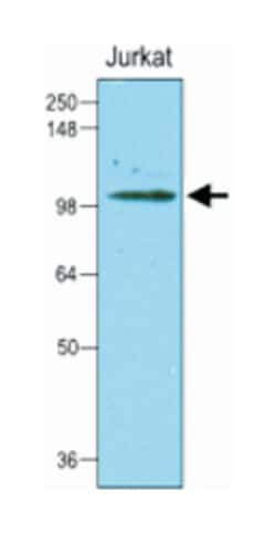 HK2, Mouse, Clone: 1A7, Abnova 100&mu;L; Unlabeled:Antibodies, Monoclonal