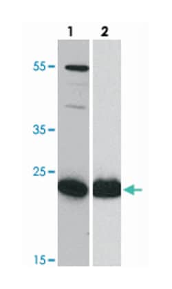 HIV-1 p24 Mouse anti-Human, Monoclonal Antibody, Abnova 100&mu;g; Unlabeled:Antibodies,