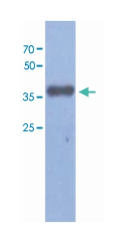 FBP2, Mouse, Clone: AT1E11, Abnova 100&mu;L; Unlabeled:Antibodies, Monoclonal