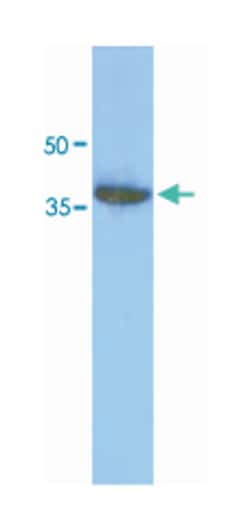 ACOT7, Mouse, Clone: AT1D5, Abnova 100&mu;L; Unlabeled:Antibodies, Monoclonal