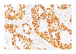 TP53, Mouse, Clone: DO7, Abnova 500&mu;L; Unlabeled:Antibodies, Monoclonal