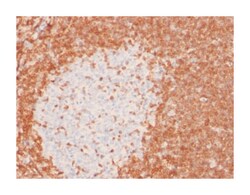 BCL2, Mouse, Clone: 8C8, Abnova 100&mu;g; Unlabeled:Antibodies, Monoclonal