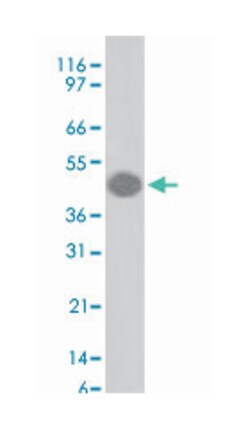 GFAP, Mouse, Clone: GA5, Abnova 100&mu;g; Unlabeled:Antibodies, Monoclonal