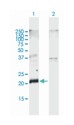 claudin 10, Mouse, Polyclonal Antibody, Abnova 50&mu;L; Unlabeled:Antibodies,