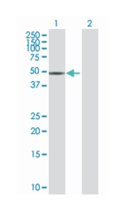 xylulokinase homolog (H. influenzae), Mouse, Polyclonal Antibody, Abnova