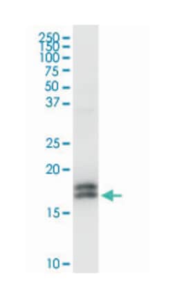 NPC2, Rabbit, Purified MaxPab Polyclonal Antibody, Abnova 100&mu;g; Unlabeled:Antibodies,