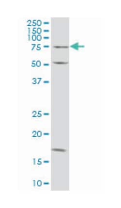 TRIM16, Mouse, Clone: 5G11, Abnova™
