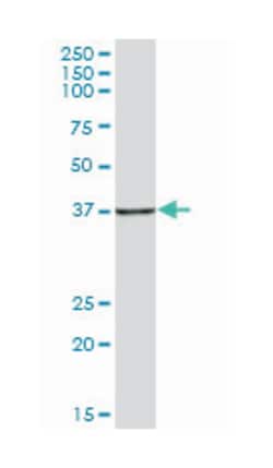 HSPA (heat shock 70kDa) binding protein, cytoplasmic cochaperone 1, Mouse,