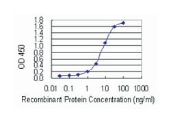 forkhead box P1, Mouse, Clone: 4E3-G11, Abnova 100 &mu;g | Buy Online | Abnova Corporation | Fisher Scientific