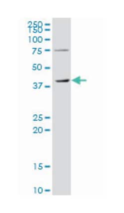 tropomodulin 3 (ubiquitous), Mouse, Polyclonal Antibody, Abnova 50&mu;L;