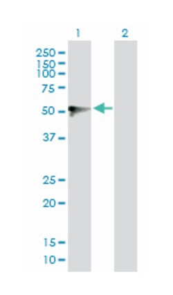 UDP glucuronosyltransferase 1 family, polypeptide A9, Rabbit, Purified