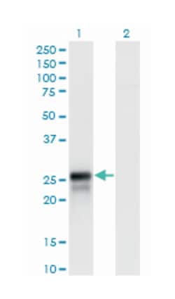 DIRAS2, Mouse, Polyclonal Antibody, Abnova 50&mu;L; Unlabeled:Antibodies,