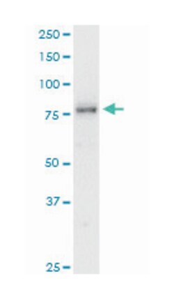 SMAD specific E3 ubiquitin protein ligase 1, Mouse, Clone: 1D7, Abnova