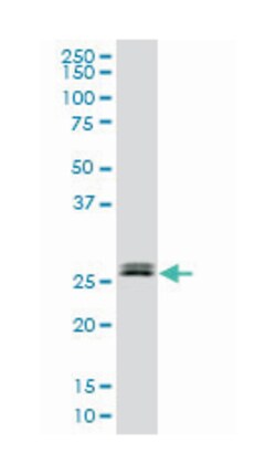 TGIF2, Mouse, Clone: 2F3, Abnova 200 &mu;L | Buy Online | Abnova Corporation | Fisher Scientific
