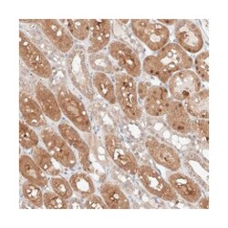 ZFHX2 Rabbit anti-Human, Polyclonal Antibody, Abnova 100 &mu;L | Buy Online | Abnova Corporation | Fisher Scientific