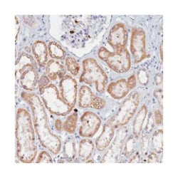 SLC26A1, Rabbit, Polyclonal Antibody, Abnova 100&mu;L; Unlabeled:Antibodies,