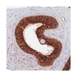 DEFB118, Rabbit, Polyclonal Antibody, Abnova 100&mu;L; Unlabeled:Antibodies,