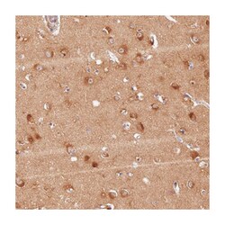 LRRC68, Rabbit, Polyclonal Antibody, Abnova 100&mu;L; Unlabeled:Antibodies,