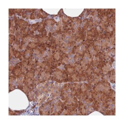 ARHGAP18 Rabbit anti-Human, Polyclonal Antibody, Abnova 100&mu;L; Unlabeled:Antibodies,