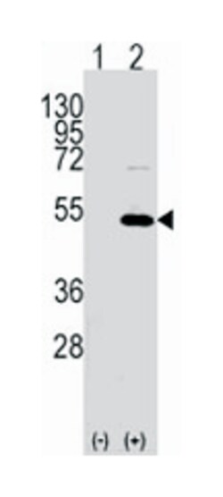 YBX1 Rabbit anti-Human, Polyclonal Antibody, Abnova 400 &mu;L | Buy Online | Abnova Corporation | Fisher Scientific