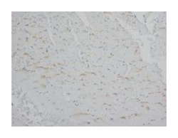 ANXA5 Rabbit anti-Human, Rat, Polyclonal Antibody, Abnova 100&mu;g; Unlabeled:Antibodies,