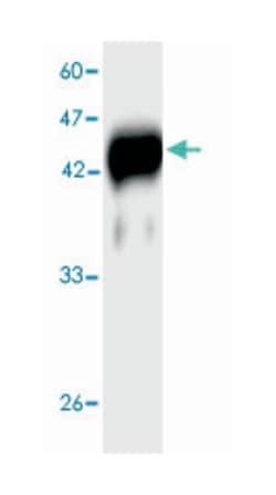 Listeria monocytogenes Hly, Mouse, Clone: 2v1d, Abnova 100 &mu;L | Buy Online | Abnova Corporation | Fisher Scientific