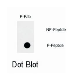 FAS (phospho Y291), Rabbit anti-Human, Polyclonal Antibody, Abnova 400 &mu;L | Buy Online | Abnova | Fisher Scientific