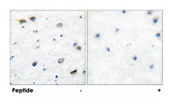GABRB1 Rabbit anti-Human, Mouse, Rat, Polyclonal Antibody, Abnova 100&mu;g;