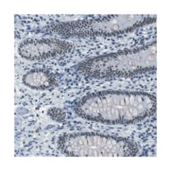 ILDR2, Rabbit, Polyclonal Antibody, Abnova 100&mu;L; Unlabeled:Antibodies,