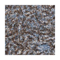 CD163L1, Rabbit, Polyclonal Antibody, Abnova 100&mu;L; Unlabeled:Antibodies,