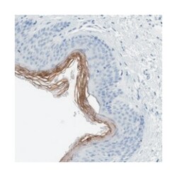 PERP Rabbit anti-Human, Polyclonal Antibody, Abnova 100&mu;L; Unlabeled:Antibodies,