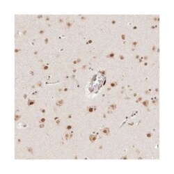 KIAA0240 Rabbit anti-Human, Polyclonal Antibody, Abnova 100&mu;L; Unlabeled:Antibodies,