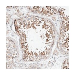 C6orf118 Rabbit anti-Human, Polyclonal Antibody, Abnova 100&mu;L; Unlabeled:Antibodies,
