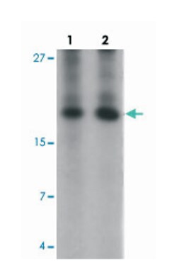 ANG, Rabbit, Polyclonal Antibody, Abnova 100&mu;g; Unlabeled:Antibodies,
