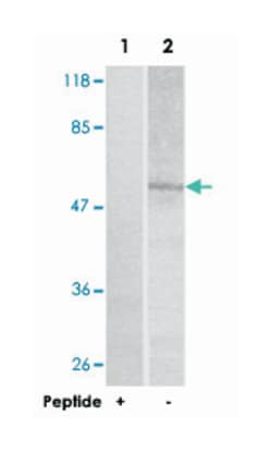 GABRB1 Rabbit anti-Human, Mouse, Rat, Polyclonal Antibody, Abnova 100&mu;g;