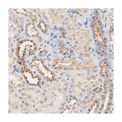 FMNL3, Rabbit, Polyclonal Antibody, Abnova 100 &mu;L | Buy Online | Abnova Corporation | Fisher Scientific