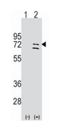 PARP6 Rabbit anti-Human, Polyclonal Antibody, Abnova 400 &mu;L | Buy Online | Abnova | Fisher Scientific