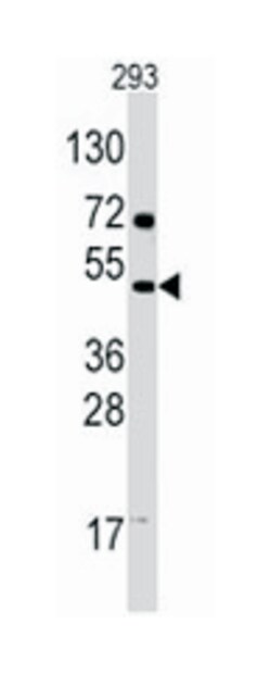 FIGF Rabbit anti-Human, Polyclonal Antibody, Abnova 400 &mu;L | Buy Online | Abnova Corporation | Fisher Scientific