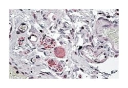 NPY5R, Goat, Polyclonal Antibody, Abnova 100 &mu;g | Buy Online | Abnova Corporation | Fisher Scientific