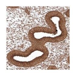 EPC2, Rabbit, Polyclonal Antibody, Abnova 100 &mu;L | Buy Online | Abnova | Fisher Scientific