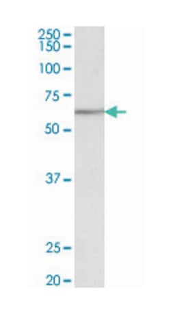 AKT2, Goat, Polyclonal Antibody, Abnova 100 &mu;g | Buy Online | Abnova Corporation | Fisher Scientific