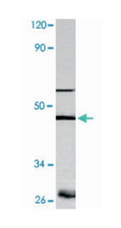 CASP9 Rabbit anti-Human, Polyclonal Antibody, Abnova 100 &mu;L | Buy Online | Abnova Corporation | Fisher Scientific