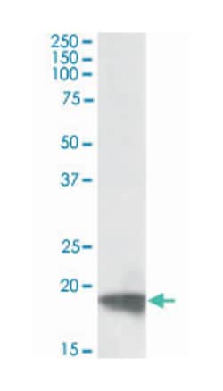 ARF4, Goat, Polyclonal Antibody, Abnova 100 &mu;g | Buy Online | Abnova Corporation | Fisher Scientific