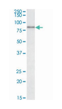 UMOD Goat anti-Human, Polyclonal Antibody, Abnova 100 &mu;g | Buy Online | Abnova Corporation | Fisher Scientific