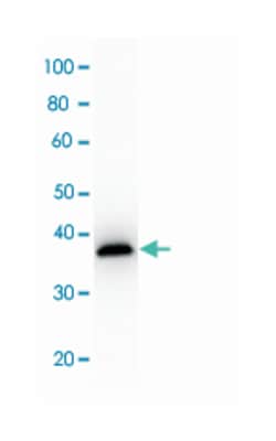 MDH1 (Pig), Sheep, Polyclonal Antibody, Abnova 100&mu;g; Unlabeled:Antibodies,