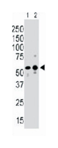 PI4K2B Rabbit anti-Human, Mouse, Polyclonal Antibody, Abnova 400 &mu;L | Buy Online | Abnova | Fisher Scientific