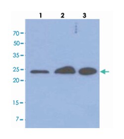 MRRF, Mouse, Clone: AT7D10, Abnova 100&mu;L; Unlabeled:Antibodies, Monoclonal